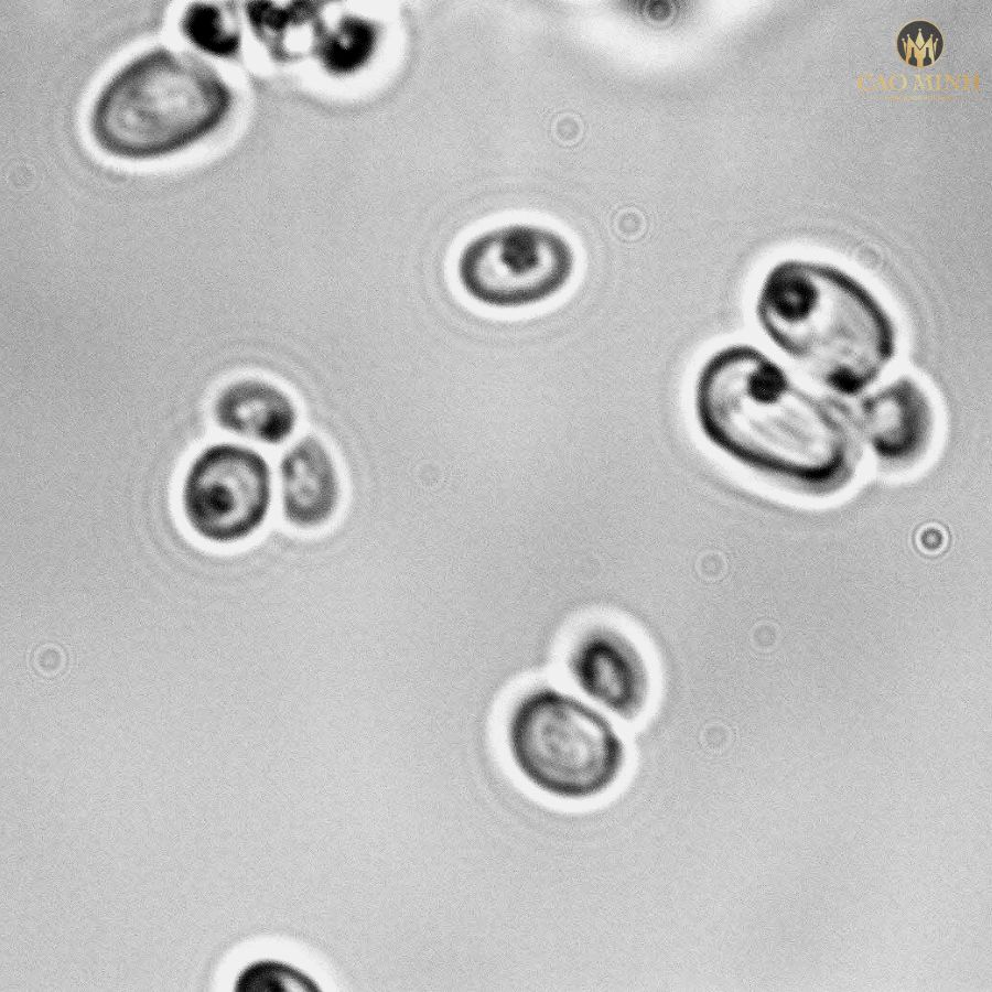 Hình ảnh trên kính hiển vi của nấm men Saccharomyces vini