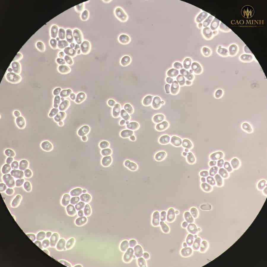 Nấm men Saccharomyces oviformis soi qua kính hiển vi